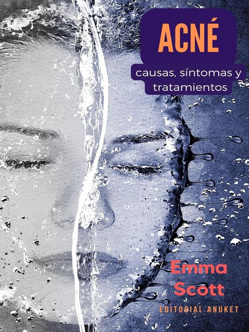 Title details for Acné by Emma Scott - Available